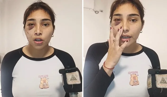 Joven tucumana denunció que fue atacada por un grupo de mujeres